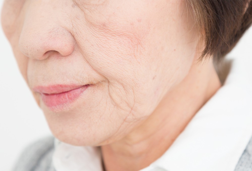 シワ・たるみ・毛穴