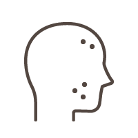 にきび・にきび痕