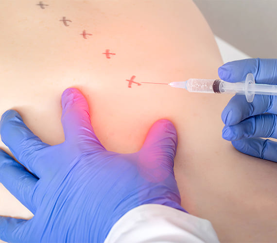 痛みの治療（神経ブロック）